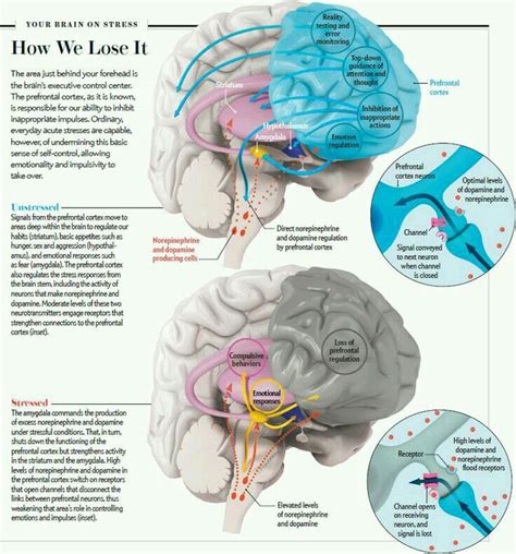 Pin By Ora Lee On Conversion Disorder Brain Science Brain Facts