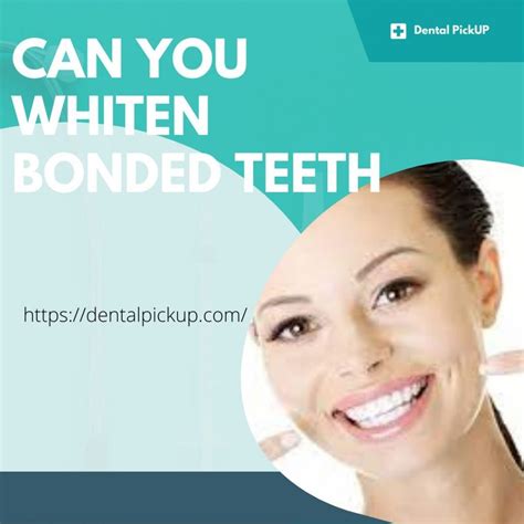 Can You Whiten Bonded Teeth Dental Pickup