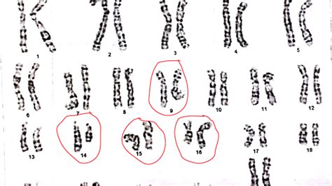 Dna Chromosome Chart