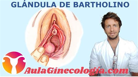 GLÁNDULA DE BARTHOLINO QUISTE BARTHOLINITIS y ABSCESO tratamiento Ginecología y