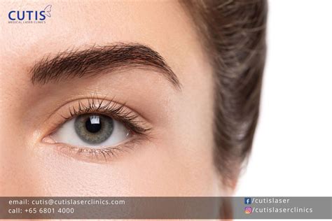 Non Surgical Alternatives To Blepharoplasty In Singapore