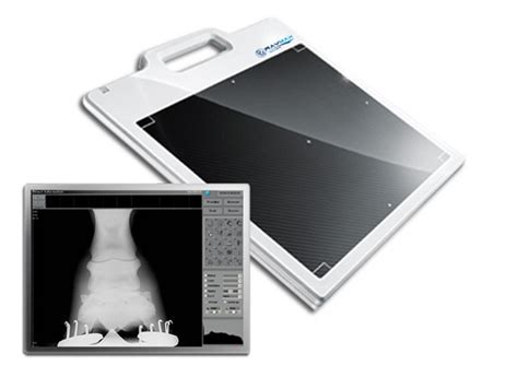 Flat Panel Type X Ray Detector Based On Tft Technology With An
