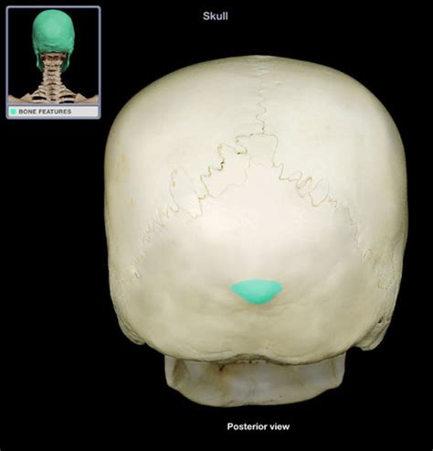 External Occipital Protuberance Massive External Occipital