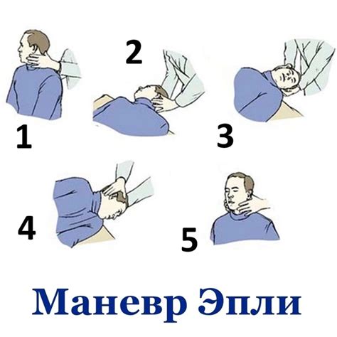 ☝️ Maneuver Epley The Epley Maneuver Or Epley Simon Gymnastics Is A