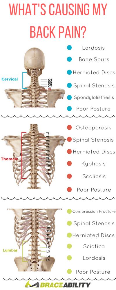 Pin On Back Injuries Spine Disorders What S Causing My Back Pain Lower Middle Upper
