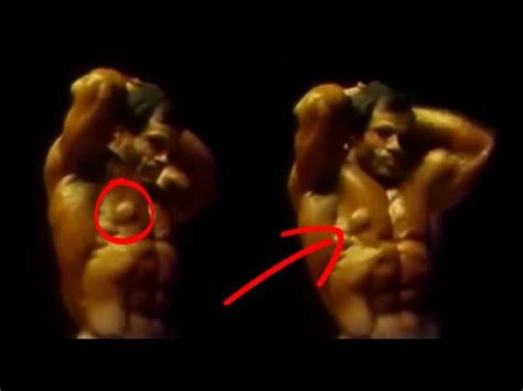 The Worst Cases Of Gyno You Will Ever See In Bodybuilding Youtube