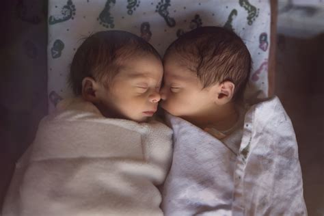 Scientists Discovered Second Ever Case Of Semi Identical Twins Born From One Egg And Two Sperm