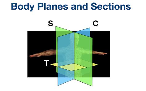 body planes and sections anatomical position directional term definitions example diagram — ezmed