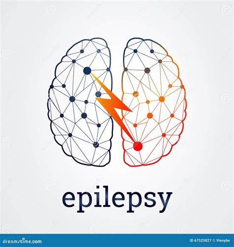 Cérebro Humano Com Atividade Da Epilepsia Ilustração Do Vetor Ilustração Do Vetor Ilustração