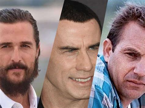 Unbelievable 10 Celebrities Who Have Had Hair Transplants