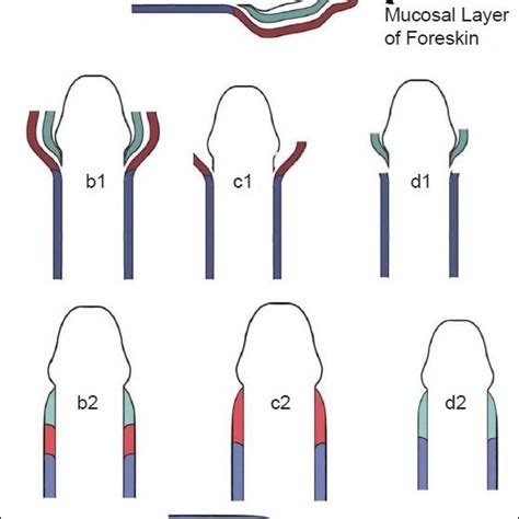 A Schematic Normal Anatomy Of Uncircumcised Human Foreskin B C