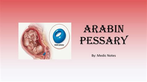 Arabin Pessary Sizes Indications Advantages Disadvantages How To