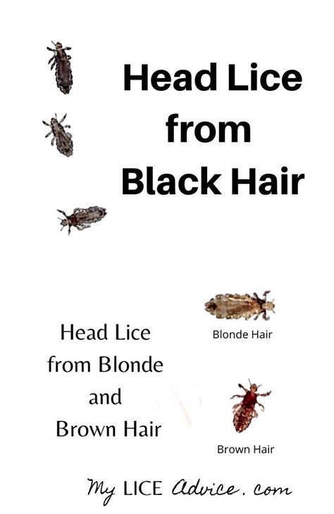 If a person notices bugs or black or brown spots on the scalp or in the hair, this usually means they have lice, not dandruff. Black Lice and Lice in Black Hair Images in 2020 | Black ...