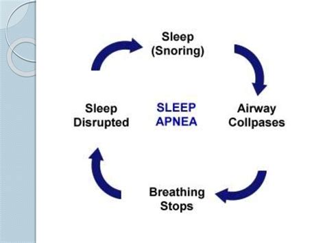 Etiology Of Obstructive Sleep Apnea