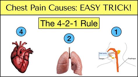 Causes Of Chest Pain Easy Trick To Never Miss An Emergency Must See Youtube