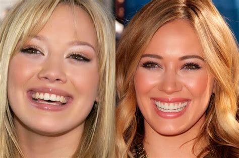 Yesterday, hilary shared a photo of her daughter banks with the caption, i'm a big sister.marinating on how i feel about that! Blog FUAD - Informasi Dikongsi Bersama: 10 Celebs Who Owe Their Smiles To Cosmetic Dentistry