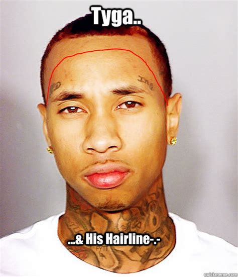 What do you call a row of bunnies replanting their garden? Tyga.. ...& His Hairline-.- - TygaHairline - quickmeme