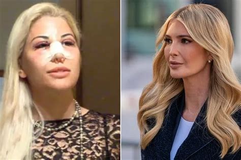 Woman Spends 60 000 On Plastic Surgery To Look Like Very Elegant