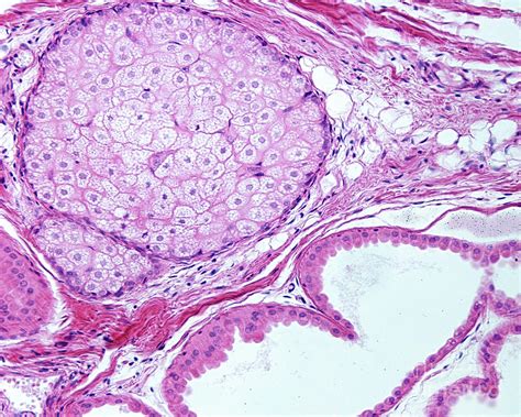 Sebaceous Gland And Apocrine Sweat Gland Photograph By Jose Calvo Science Photo Library Pixels