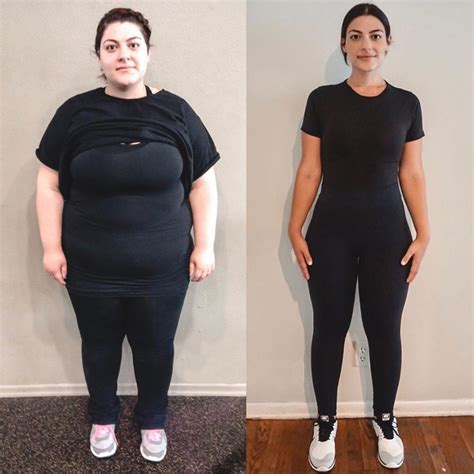 This Woman Learned Her Weight Loss Journey Wasnt Over Even After Losing 170 Pounds