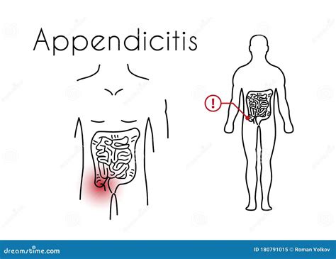 Vector Appendicitis Linear Icon Of Young Man Stock Vector