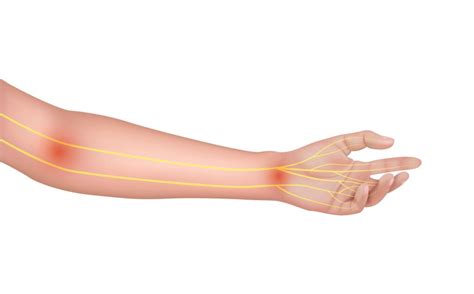Left Hand Pain 10 Reasons You Should Know