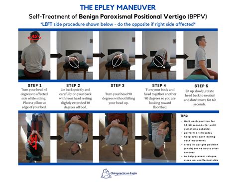 22 Epley Maneuver Patient Instructions 