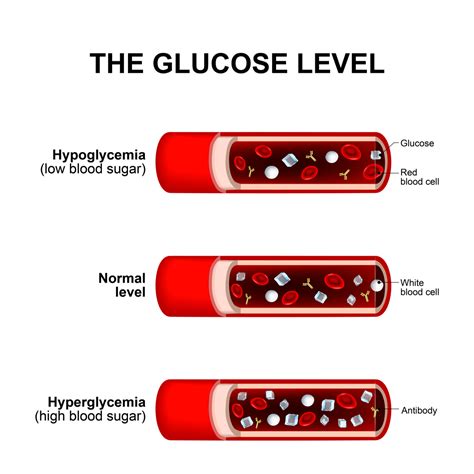 Blood Sugar Levels How Glucose Levels Affect Your Body Breathe Well