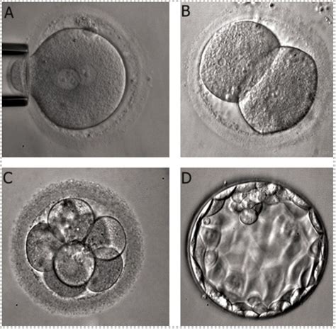 Figure Stages Of Embryo Development A Statpearls Ncbi Bookshelf