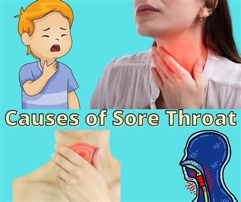 Throat Infection Symptoms Archives • Pharmacy Education