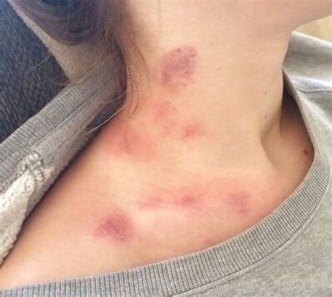 Give Her Some Hickey Lashkry