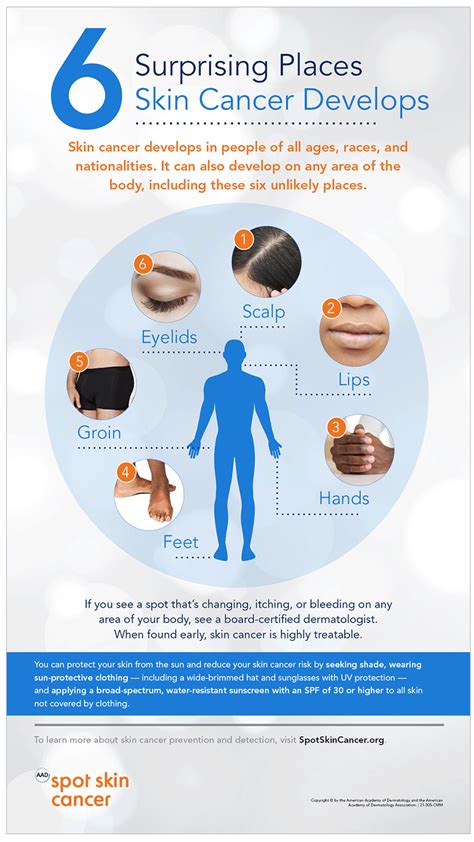 Skin Cancer Causes And Risk Factors