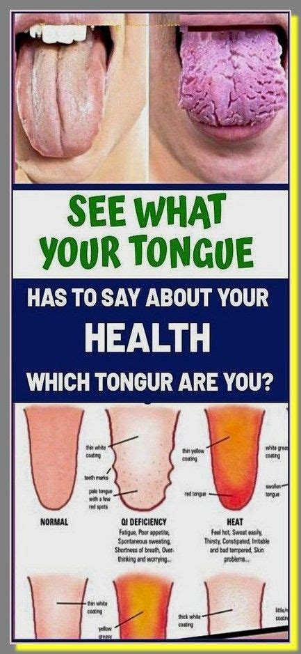 What Does Your Tongue Say About Your Health Tongue Health Healthy Routine Good Health Tips