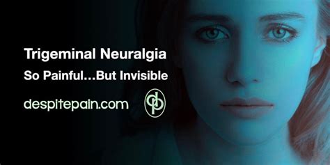 Trigeminal Neuralgia So Painful But Its Invisible Despite Pain