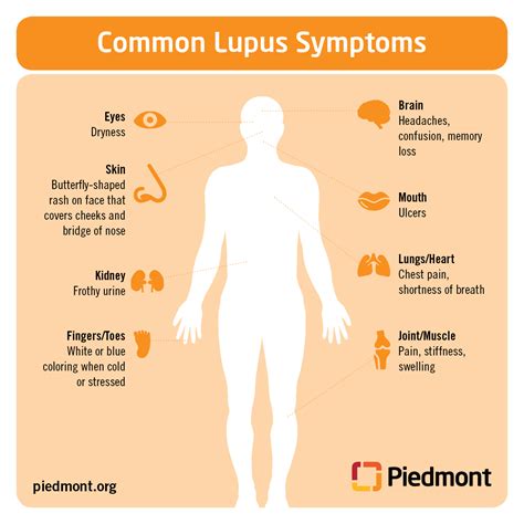 Lupus Causes Symptoms And Treatment Information Piedmont Healthcare