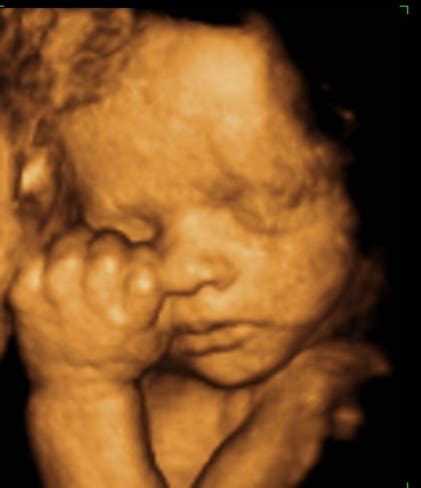 3d ultrasound in delhi, 4d scans are also similar to 3d ultrasound scans; Single Working Mom: 29 Week 3d Ultrasound