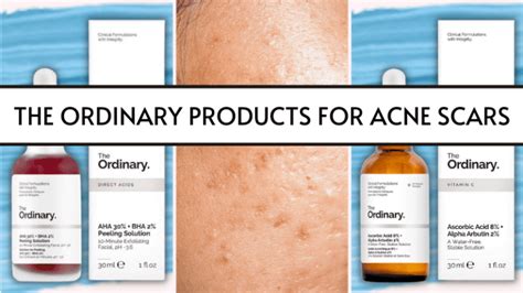 10 Best The Ordinary Products For Acne Scars That Actually Work