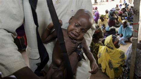 Malnutrição Mata No Huambo