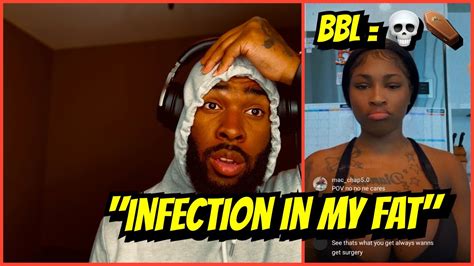 Onlyfans Dime Racks Talks Bbl Cause Sickness The First Bbl Vlog Of The Sickness Youtube