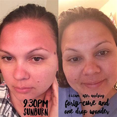 Pin By Nikki Campbell On Limelight By Alcone Skin Care Results
