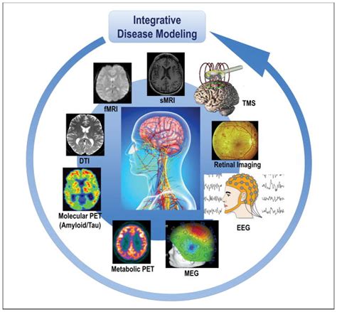 Revolution Of Alzheimer Precision Neurology Passageway Of Systems