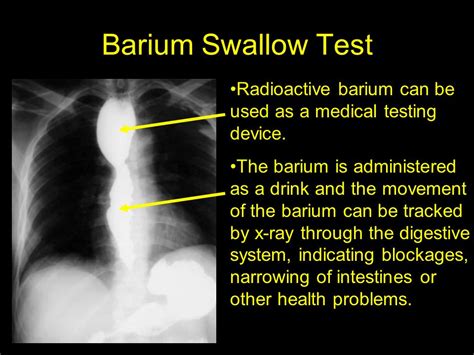 Risks Of Barium Swallow The Request Could Not Be Satisfied