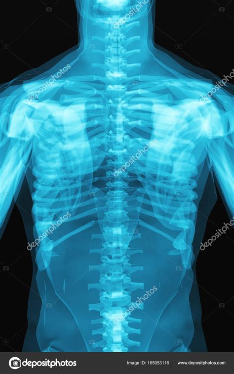 X Ray Scan Of The Human Body — Stock Photo © Scanrail 165053116
