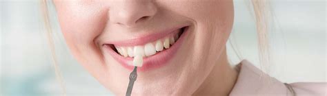 Porcelain Veneers Cost 3 Factors That Affect Pricing