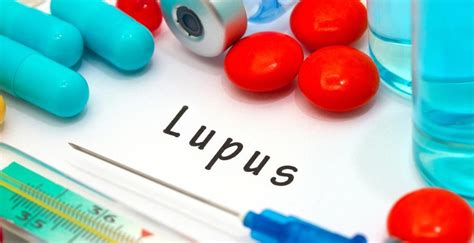 Know About The Common Risk Factors For Lupus