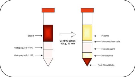 Neutrophil Isolation From Human Blood Using Histopaque Double Density