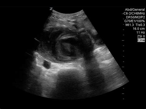 Point Of Care Ultrasound Archiving Requirements Emottawa Blog