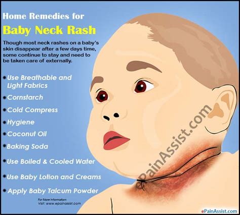 Causes And Home Remedies For Baby Neck Rash
