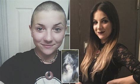 Student Forced To Shave Her Head After Trichotillomania Daily Mail Online