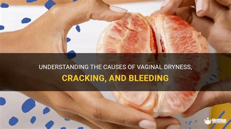 Understanding The Causes Of Vaginal Dryness Cracking And Bleeding
